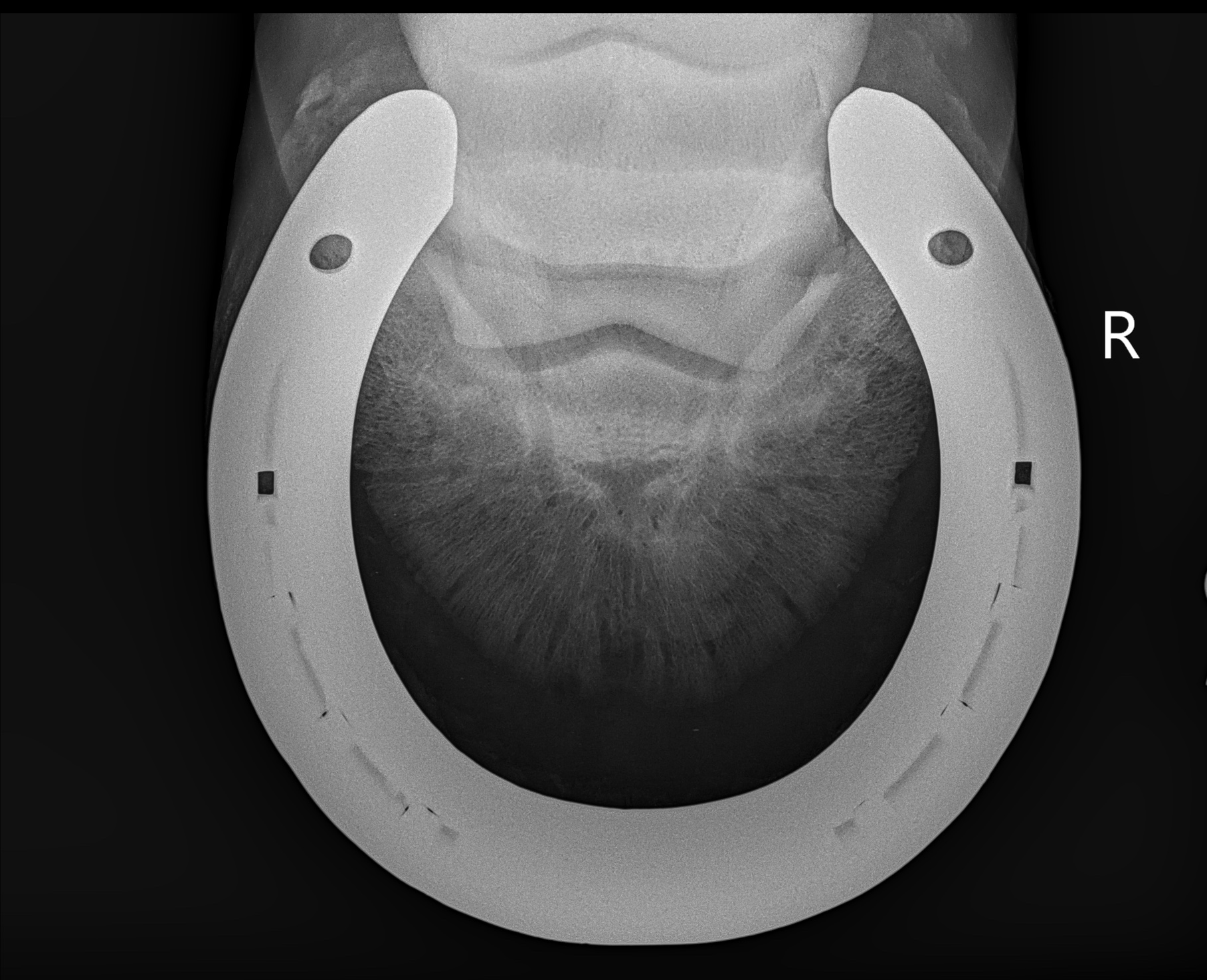 Previous Xray radiograph